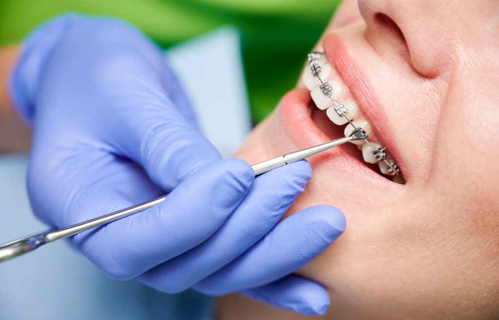 orthodontic treatment in Coeur d'Alene