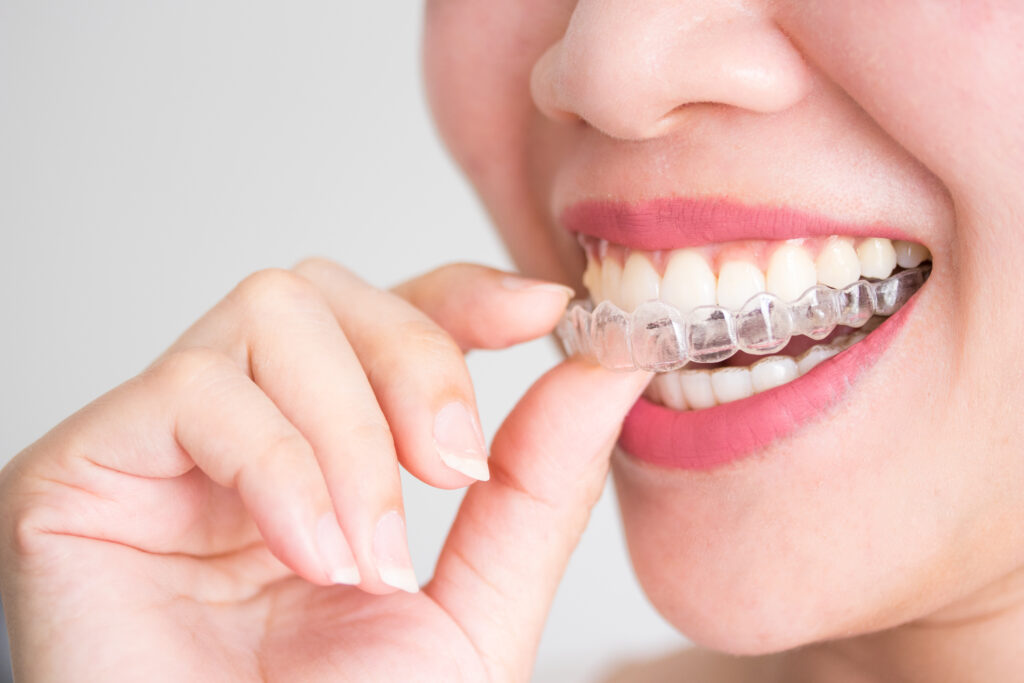 Invisalign Treatment and Aftercare Tips