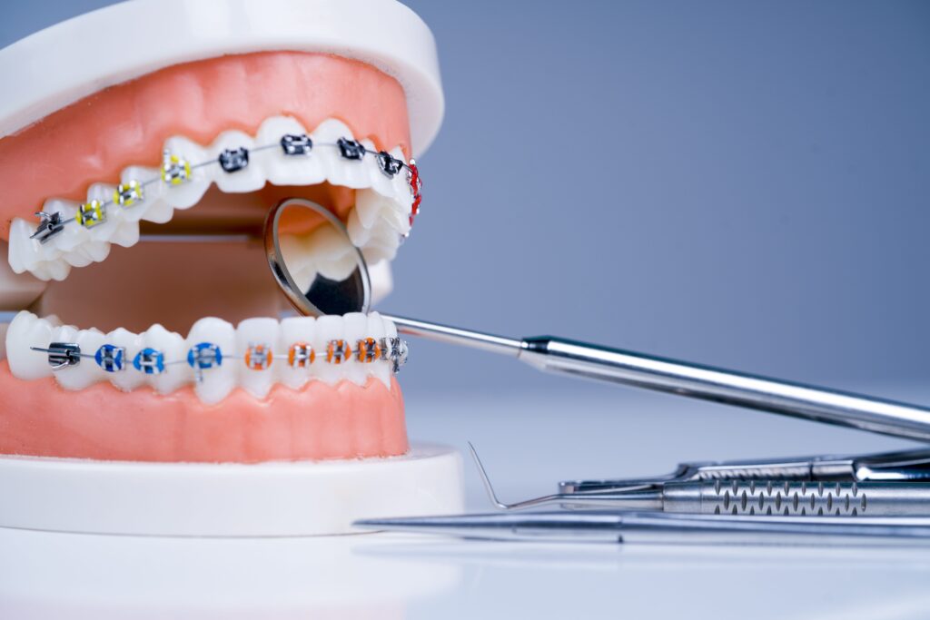 Can Orthodontic Treatment Really Help You Keep Your Teeth Longer?